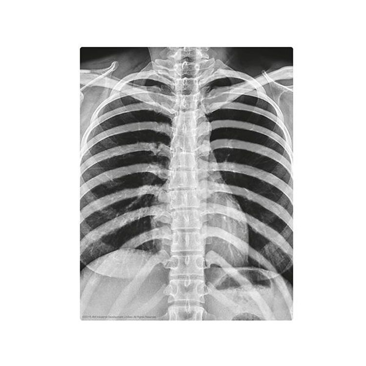 Набор юного врача «Скелет человека» — картинка 4